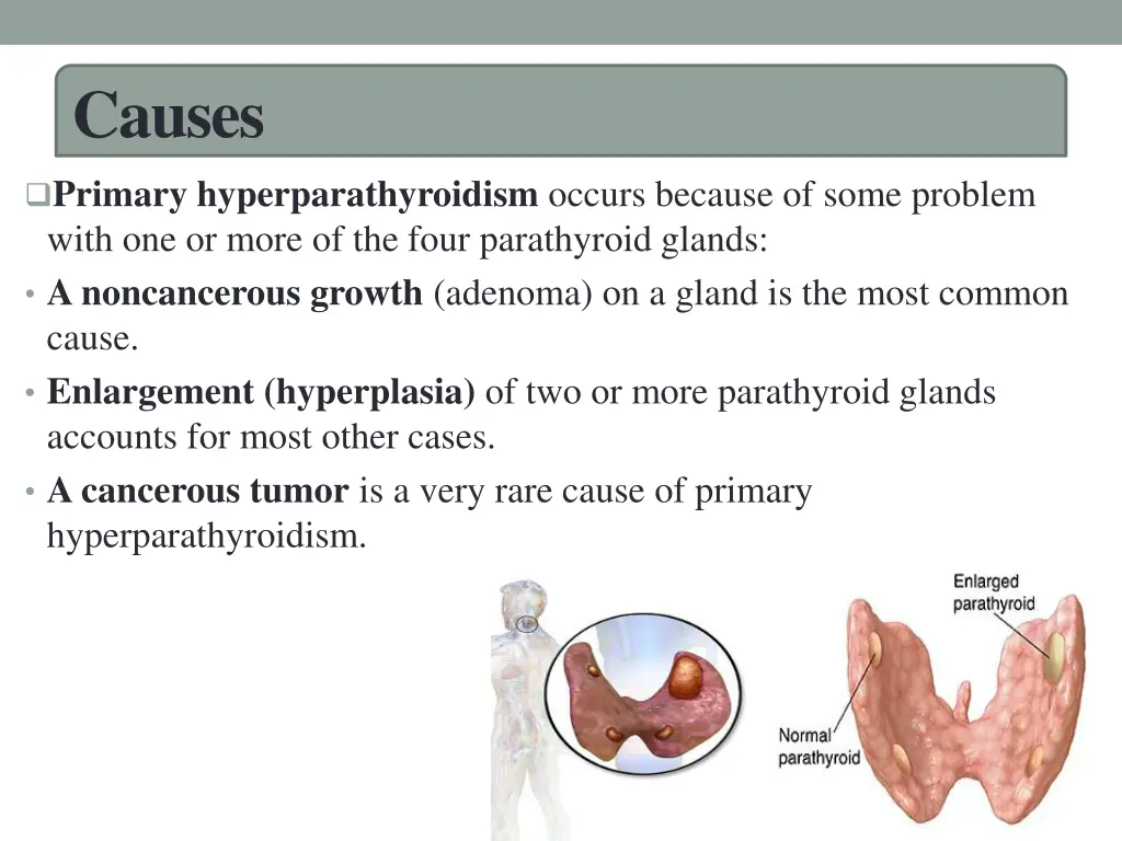 causes