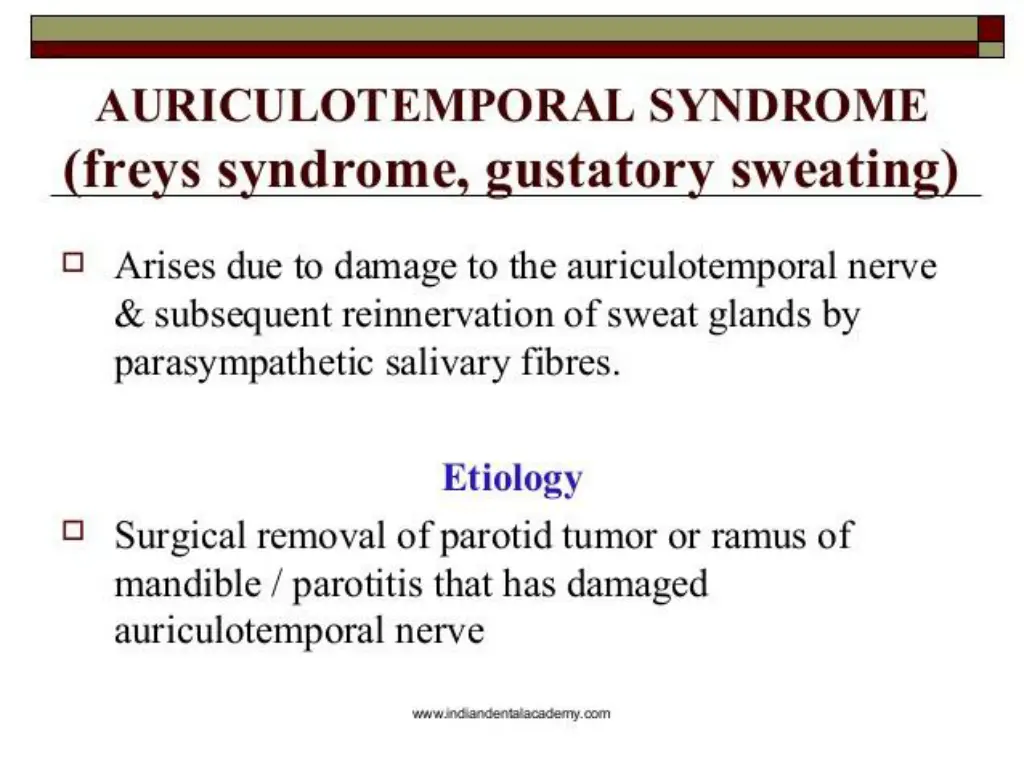 slide11
