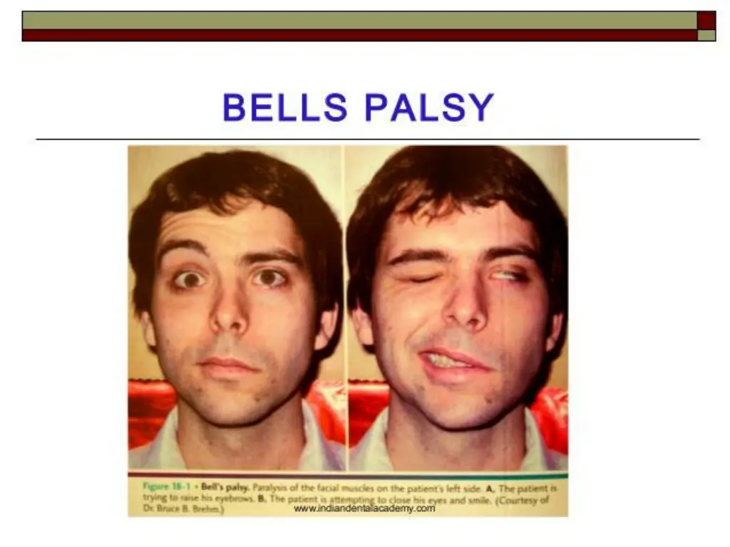 slide16