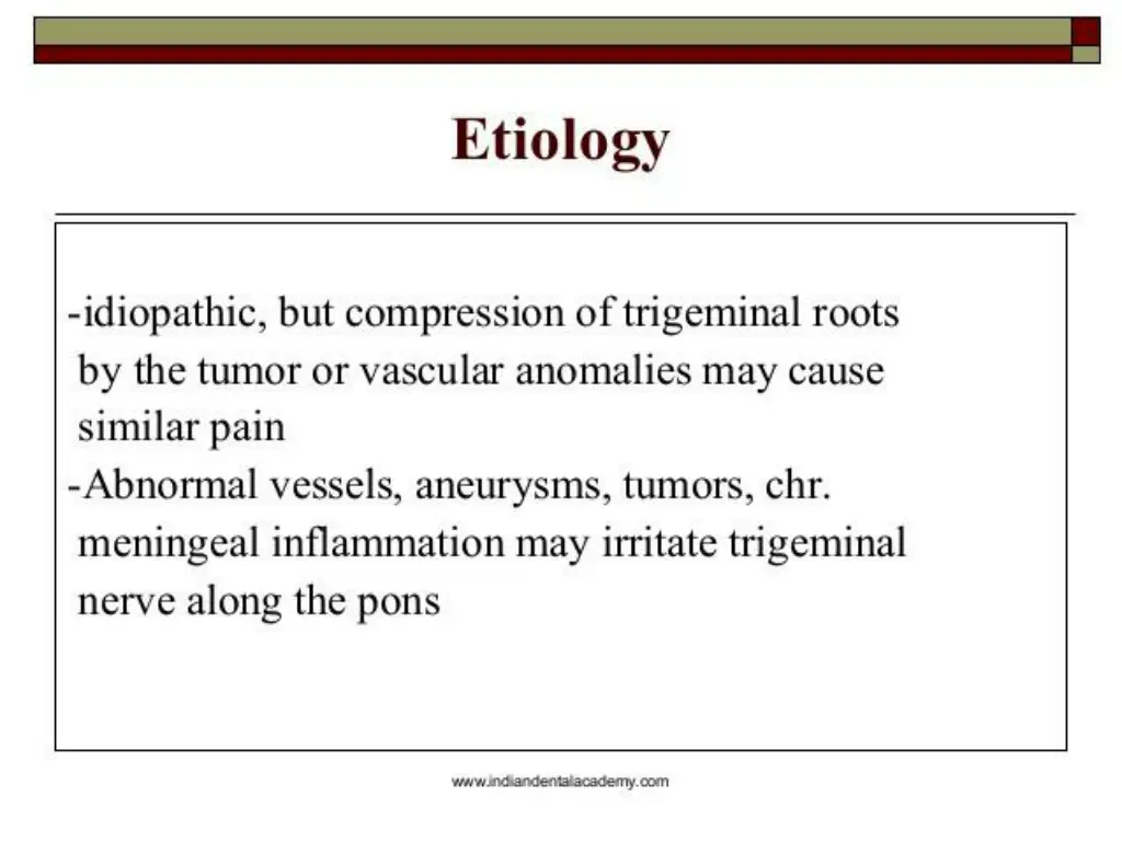 slide3