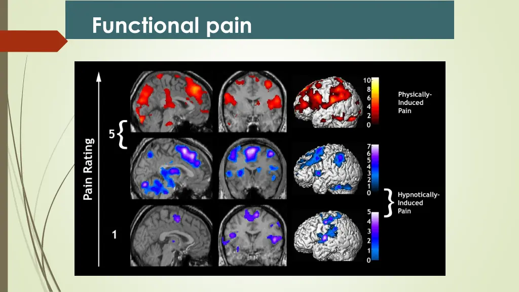 functional pain 1