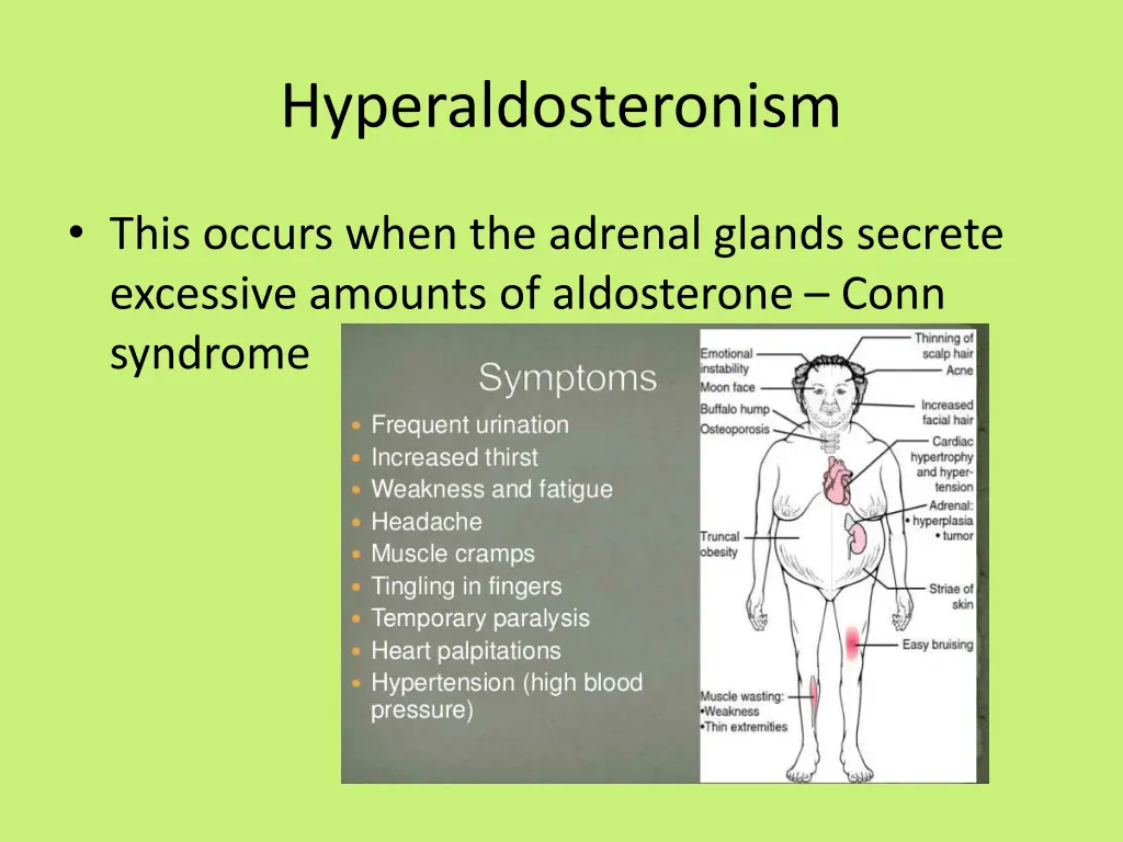 hyperaldosteronism