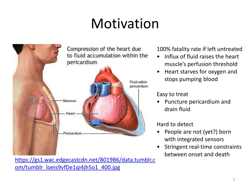 motivation