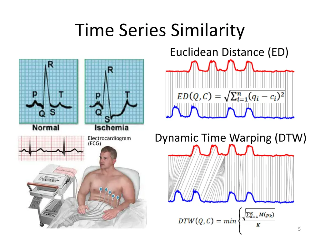 time series similarity