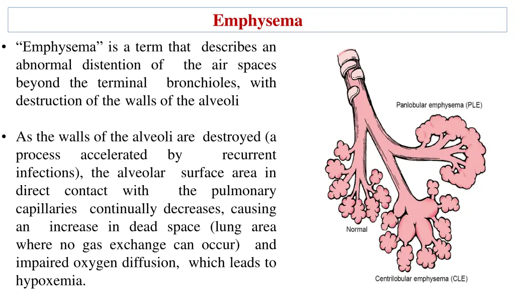 emphysema