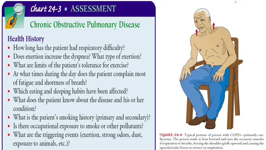 slide15
