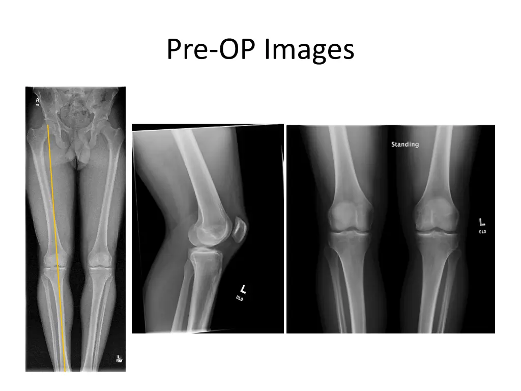 pre op images