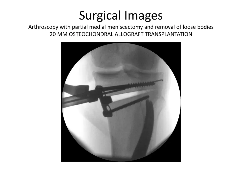 surgical images