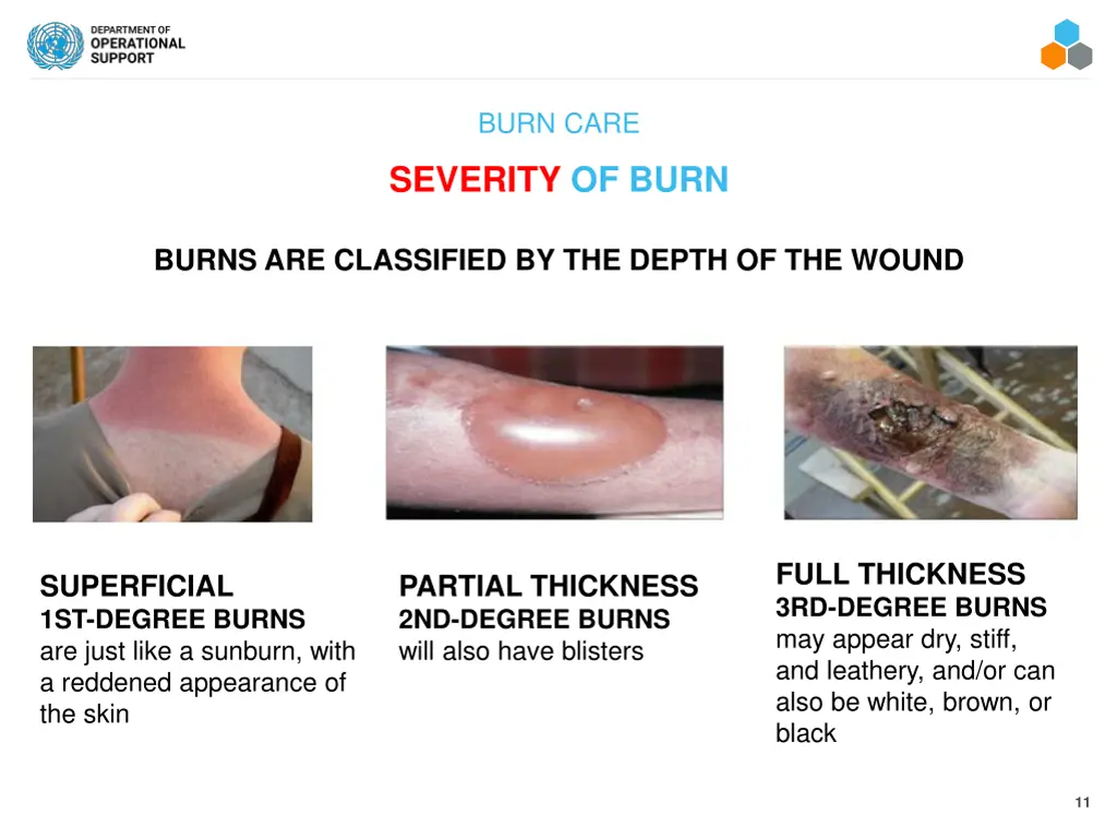 burn care 5