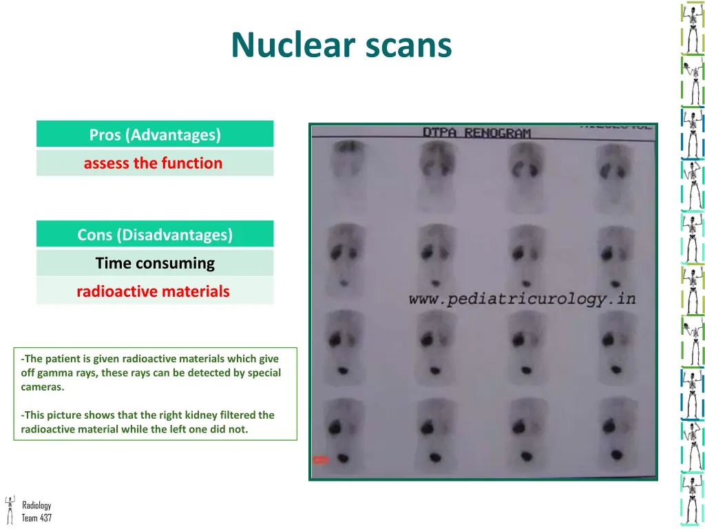 nuclear scans