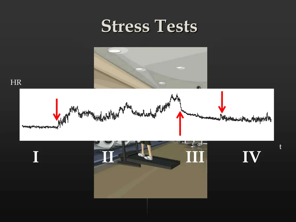 stress tests