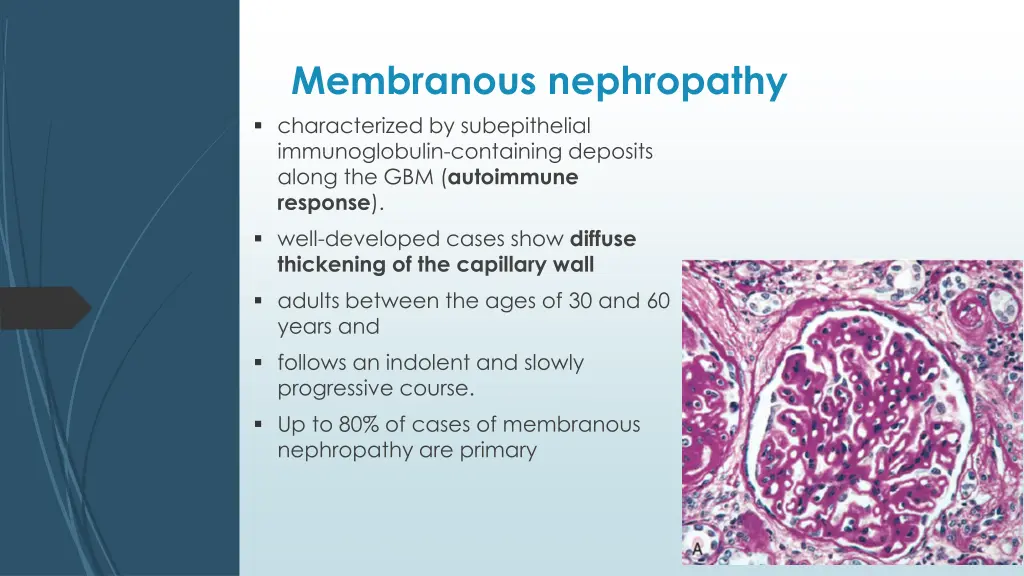 membranous nephropathy characterized