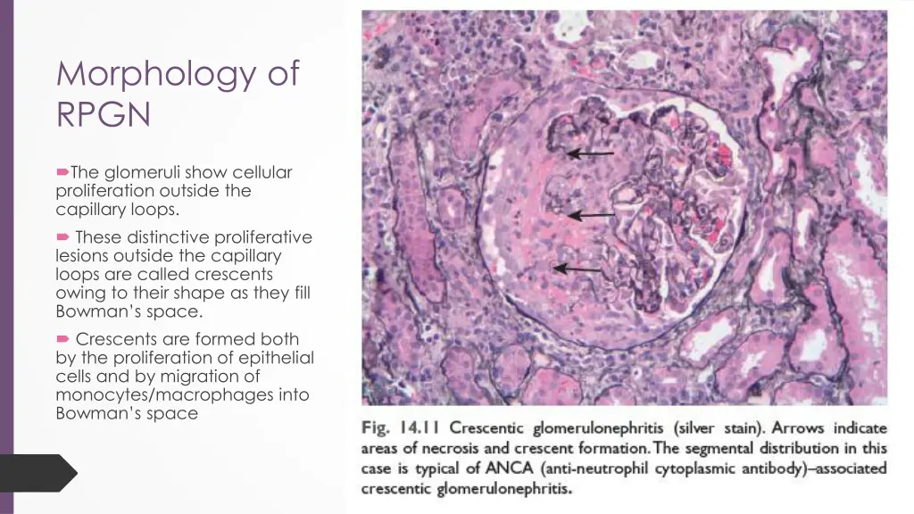 morphology of rpgn