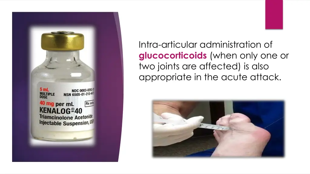 intra articular administration of glucocorticoids