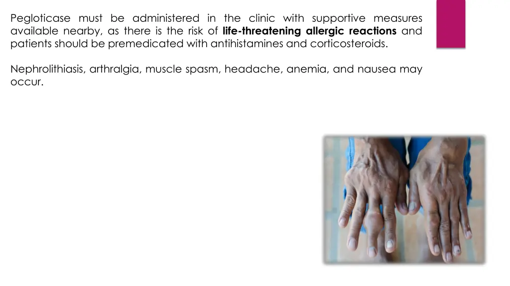 pegloticase must be administered in the clinic