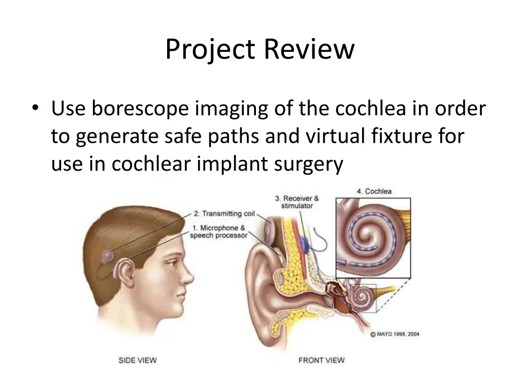 project review