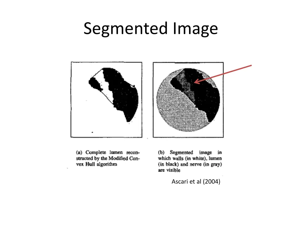 segmented image