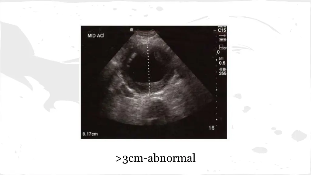 3cm abnormal