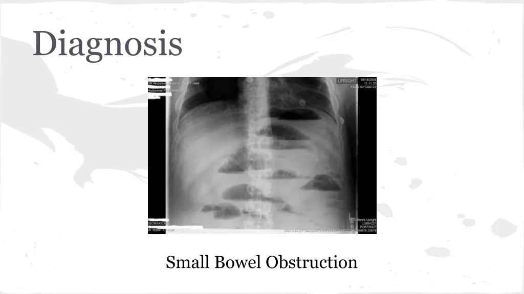 diagnosis