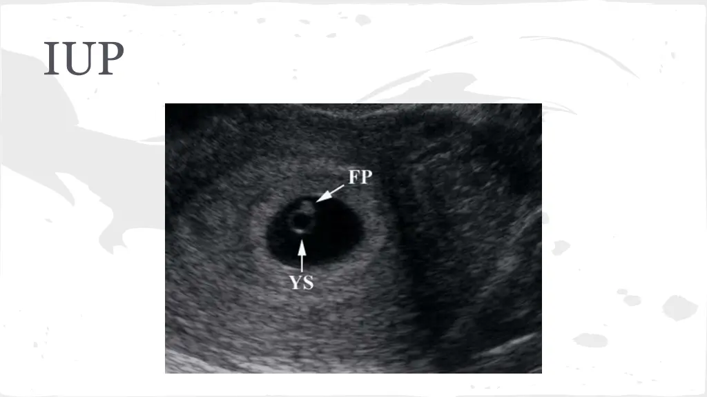slide29