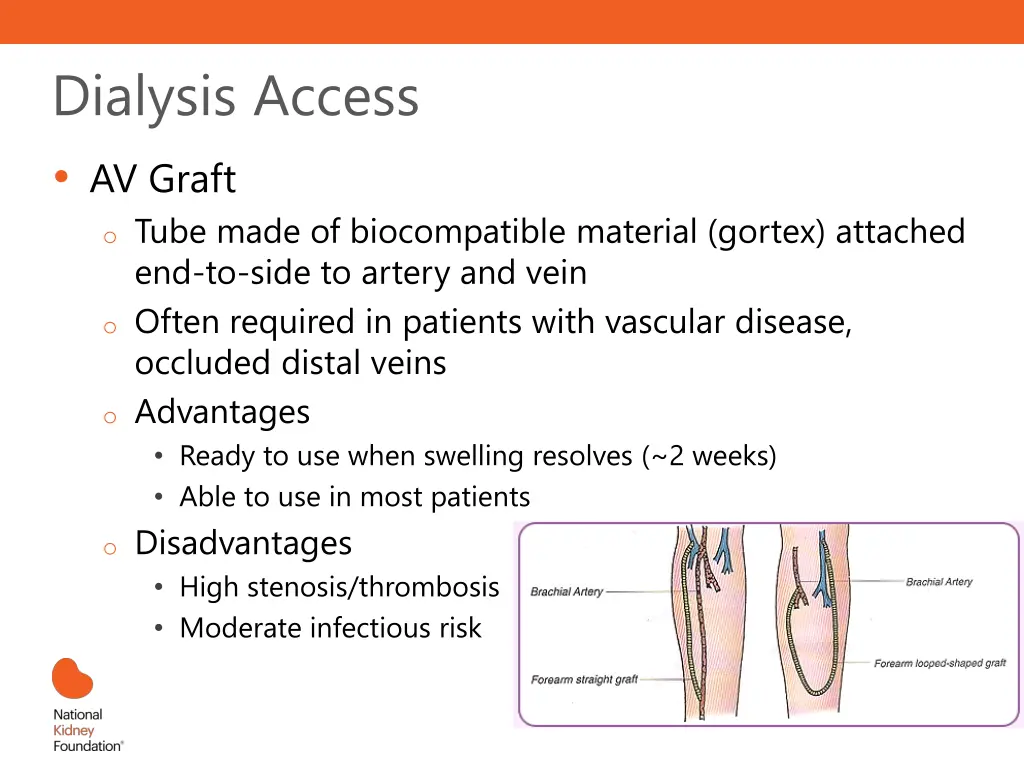 dialysis access av graft o tube made