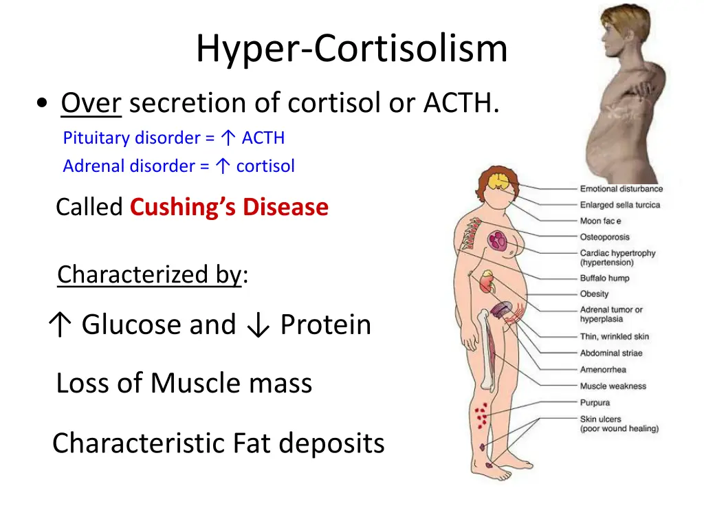hyper cortisolism