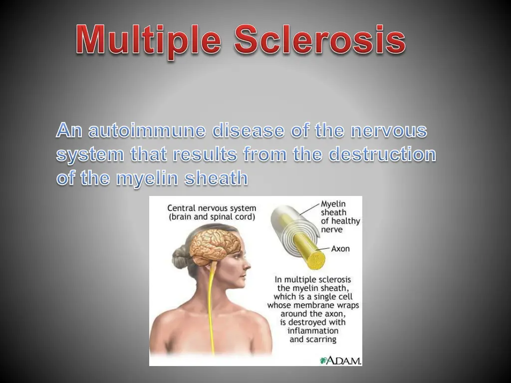 an autoimmune disease of the nervous system that