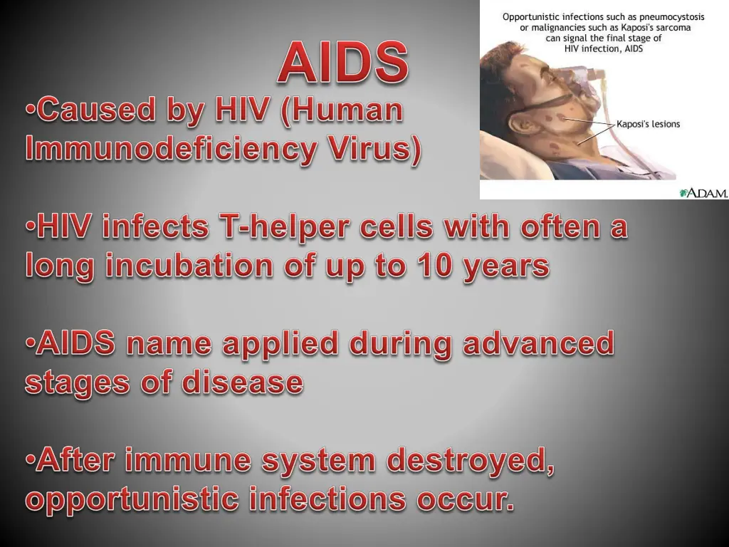 slide33
