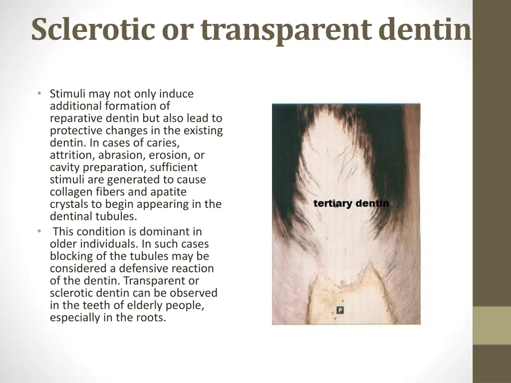 sclerotic or transparent dentin