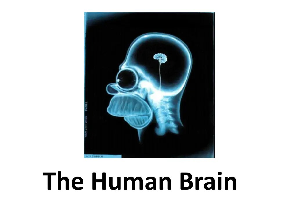 the human brain
