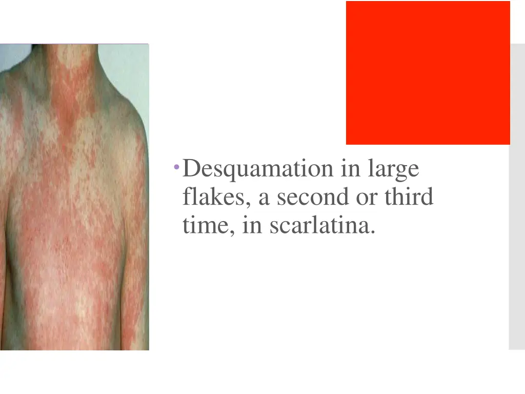 desquamation in large flakes a second or third