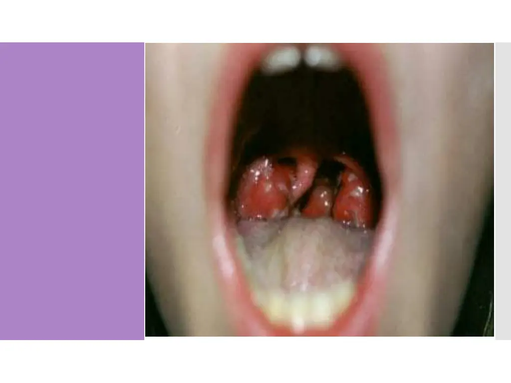 slide30