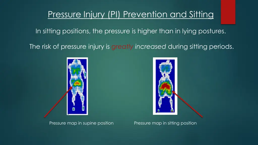 pressure injury pi prevention and sitting