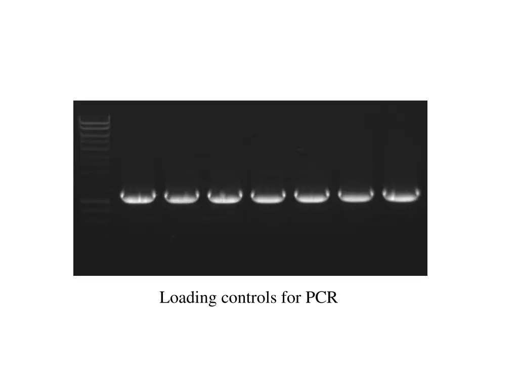 loading controls for pcr