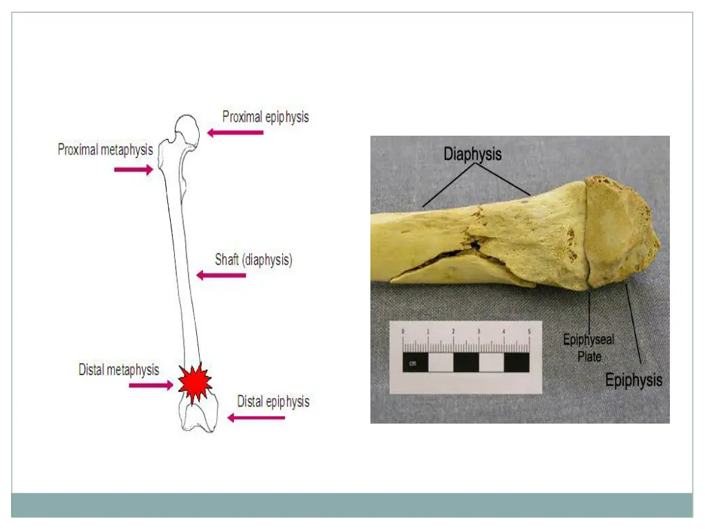 slide5