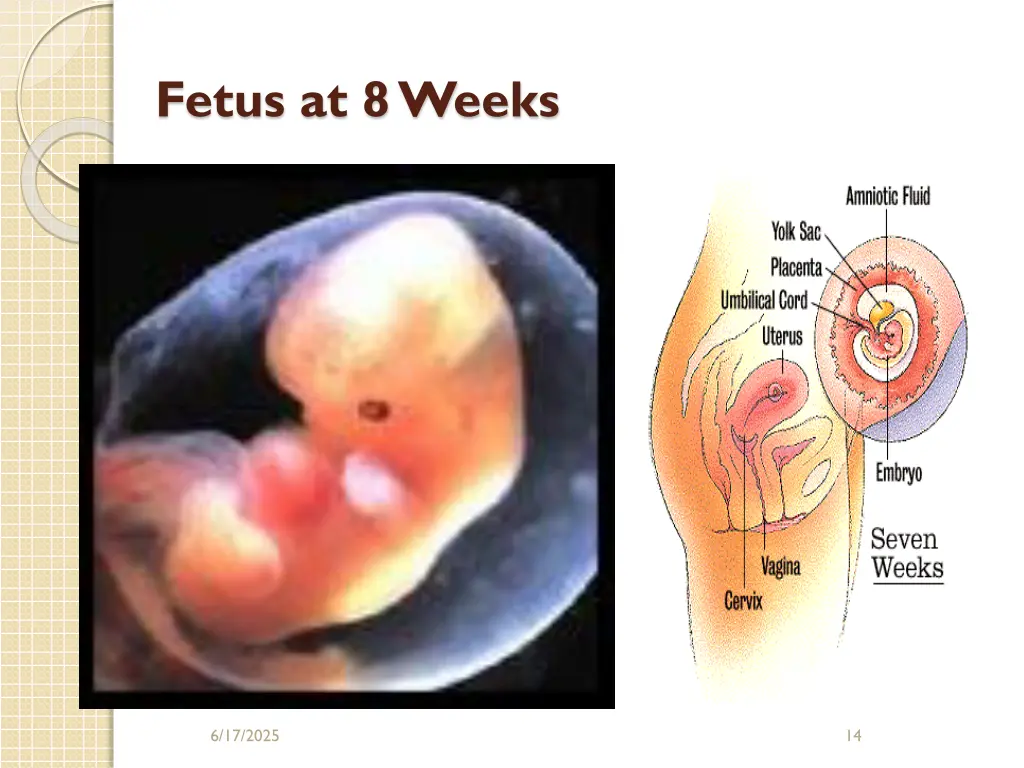 fetus at 8 weeks