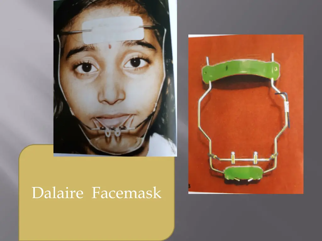 dalaire facemask