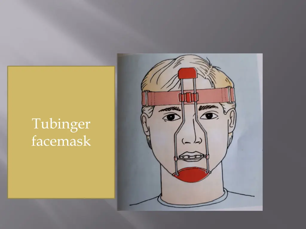 tubinger facemask