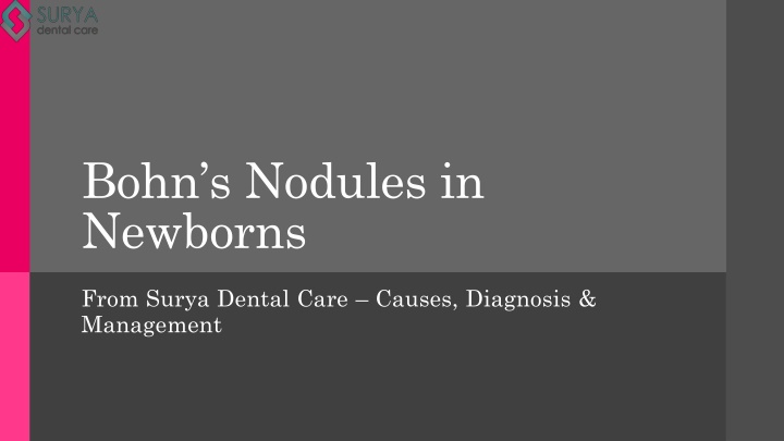 bohn s nodules in newborns