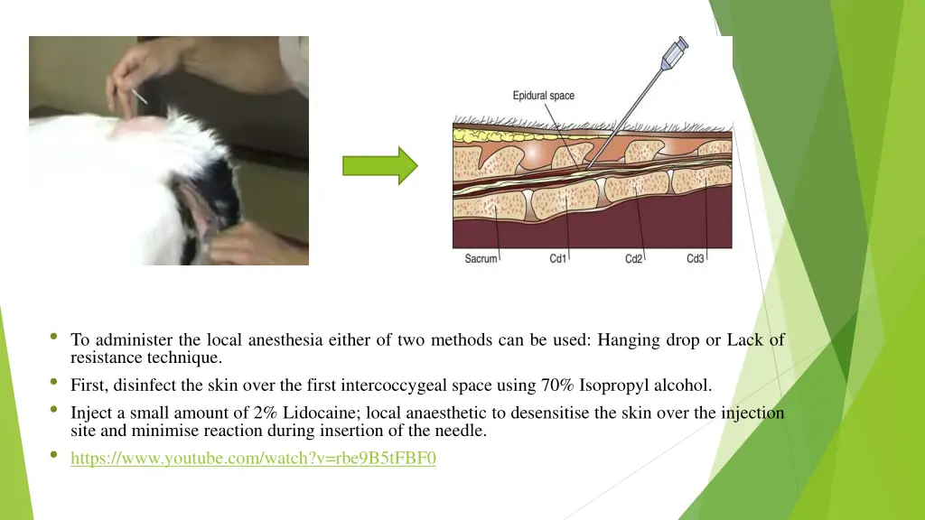 to administer the local anesthesia either