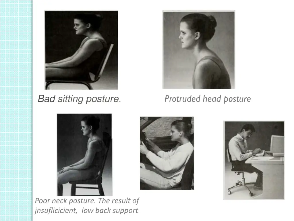 bad sitting posture