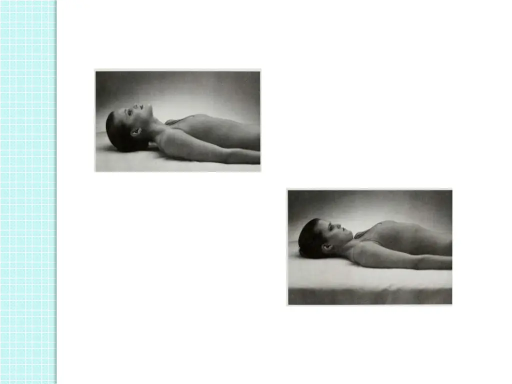 slide25