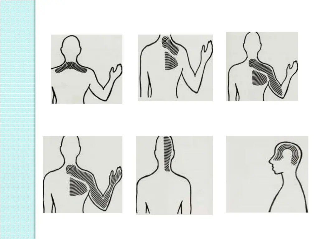 slide9