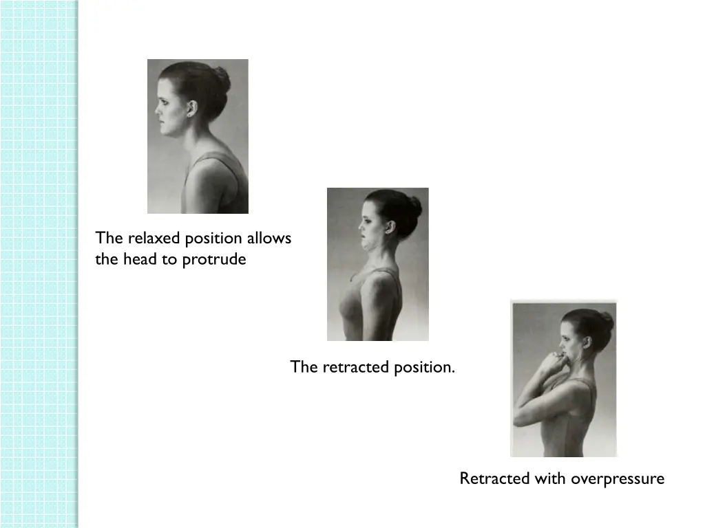 the relaxed position allows the head to protrude