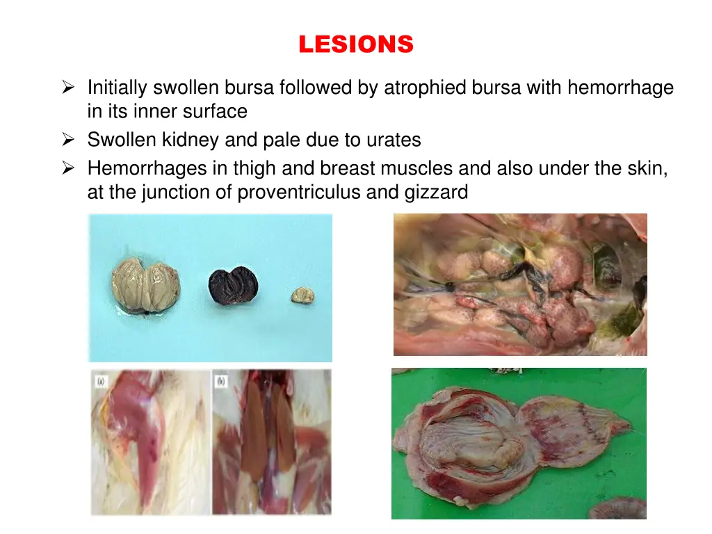 lesions
