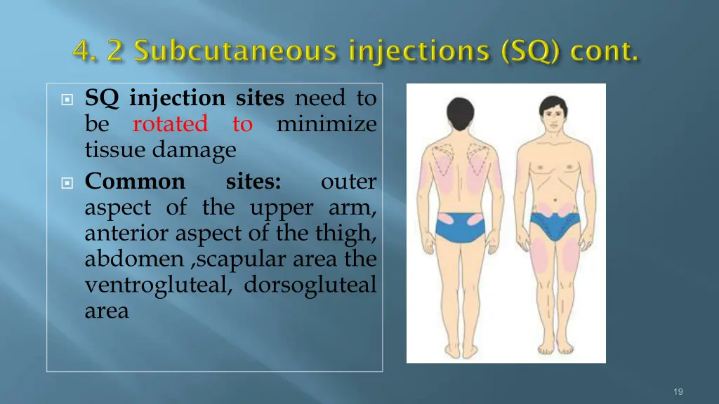 sq injection sites need to be rotated to minimize