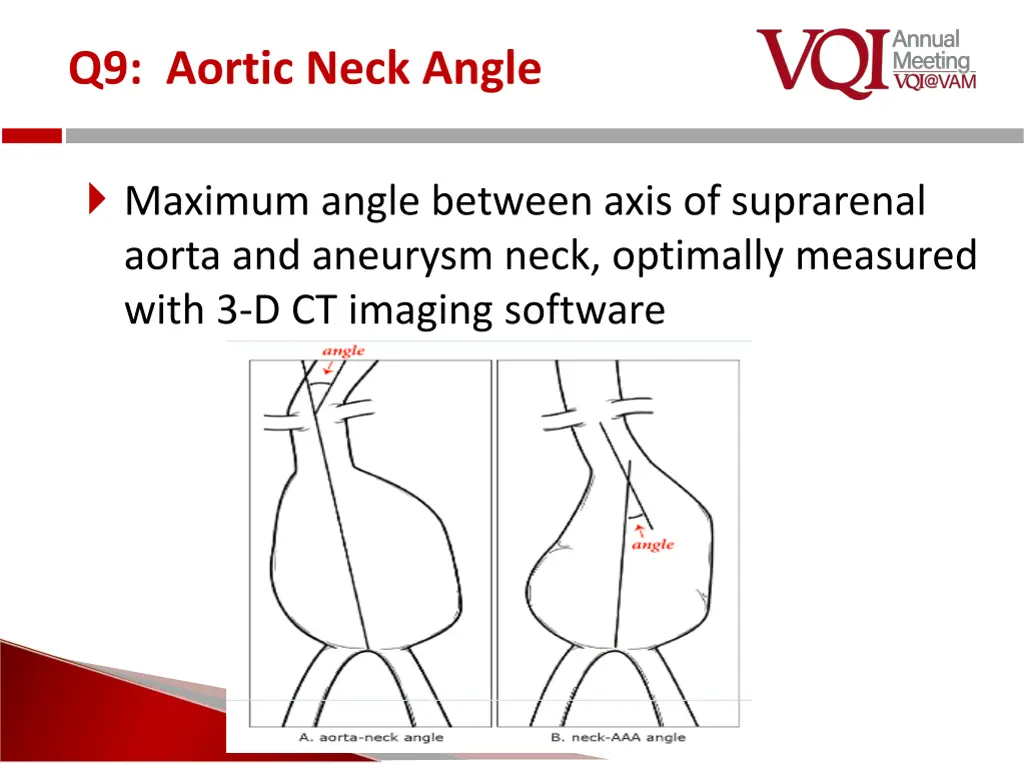 q9 aortic neck angle