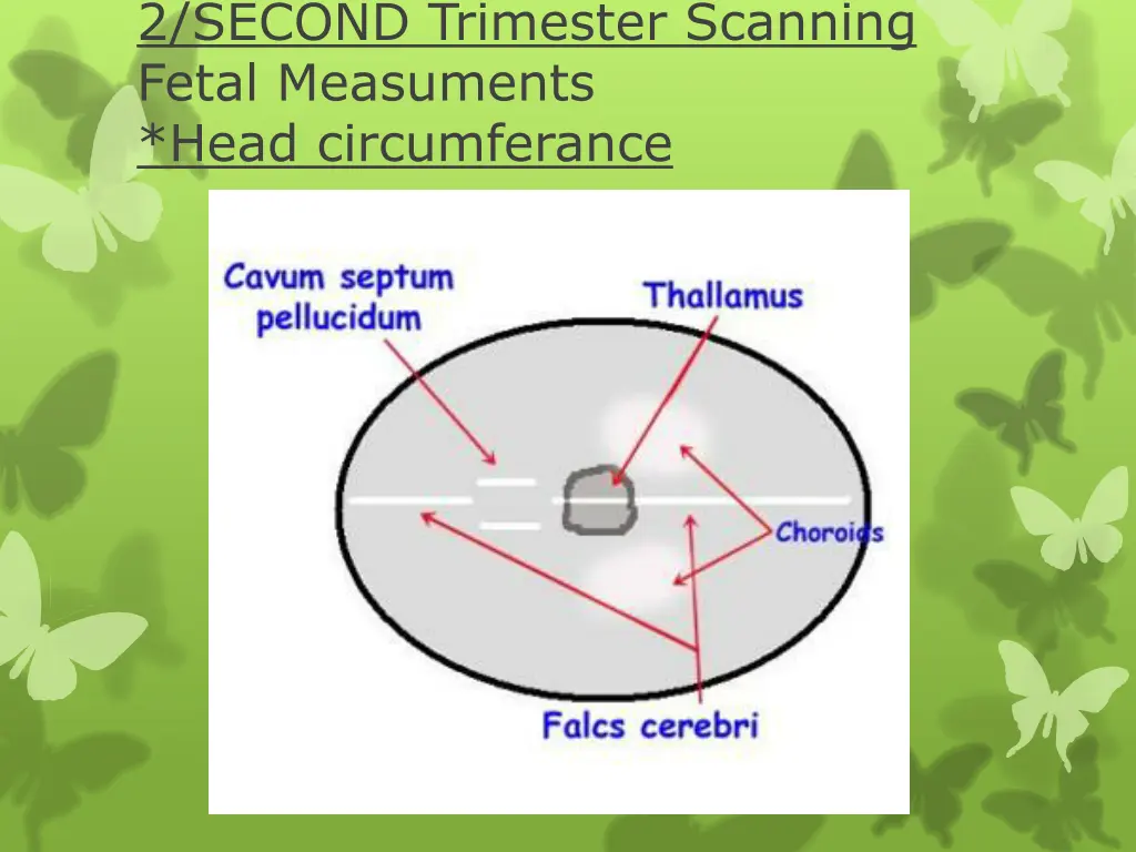2 second trimester scanning fetal measuments head