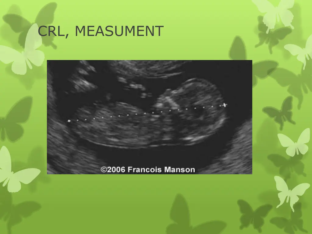 crl measument