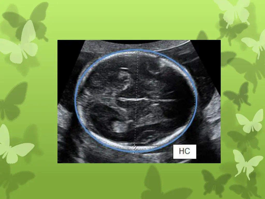 slide13